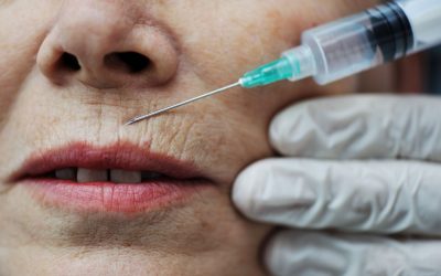 Frequently Asked Questions About Botox Injections Ann Arbor MI for First-Time Patients