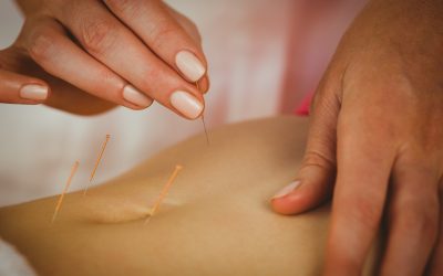 Stay Licensed and Informed by Choosing Acupuncture CEU Courses Texas Approves